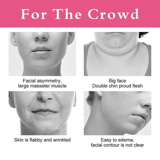 Double chin reducer strap