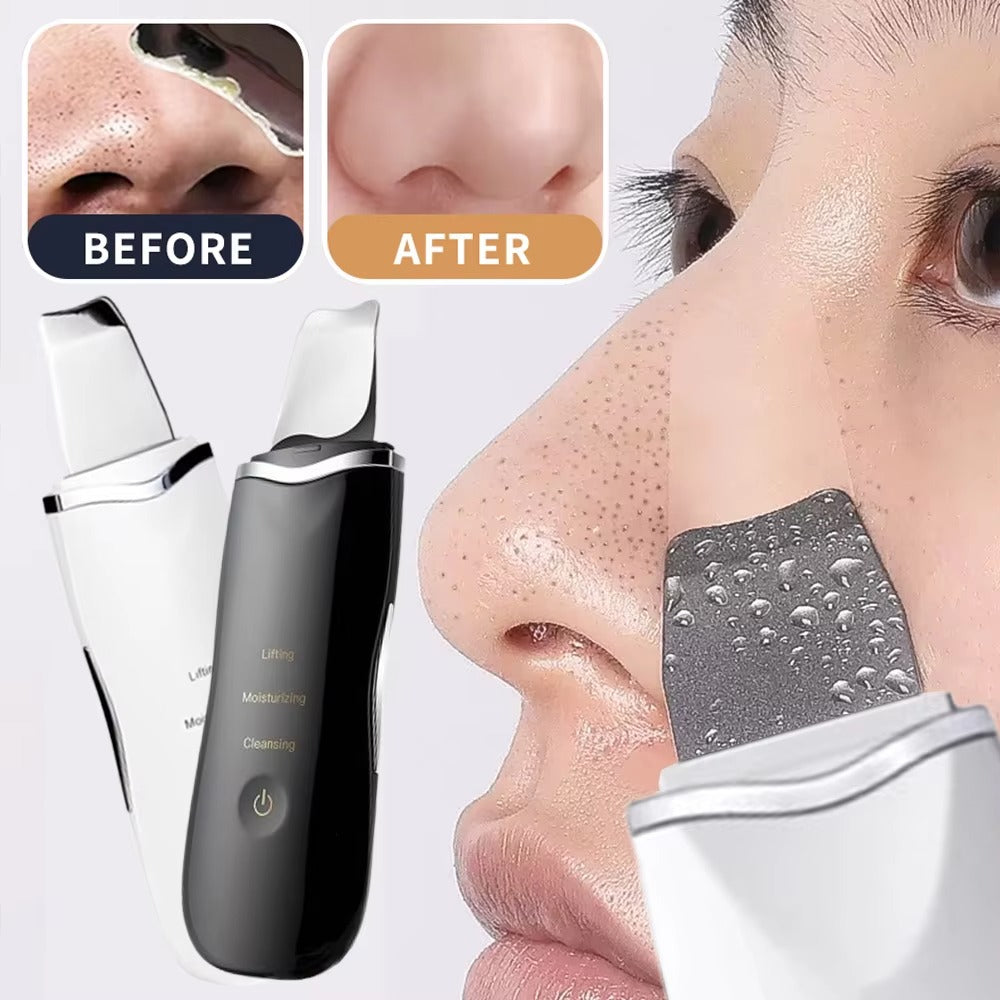 Electric Skin Scrubber