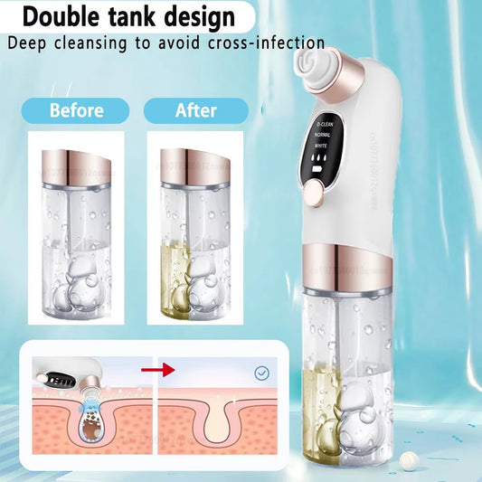 Pore Vacuum Face Cleaner