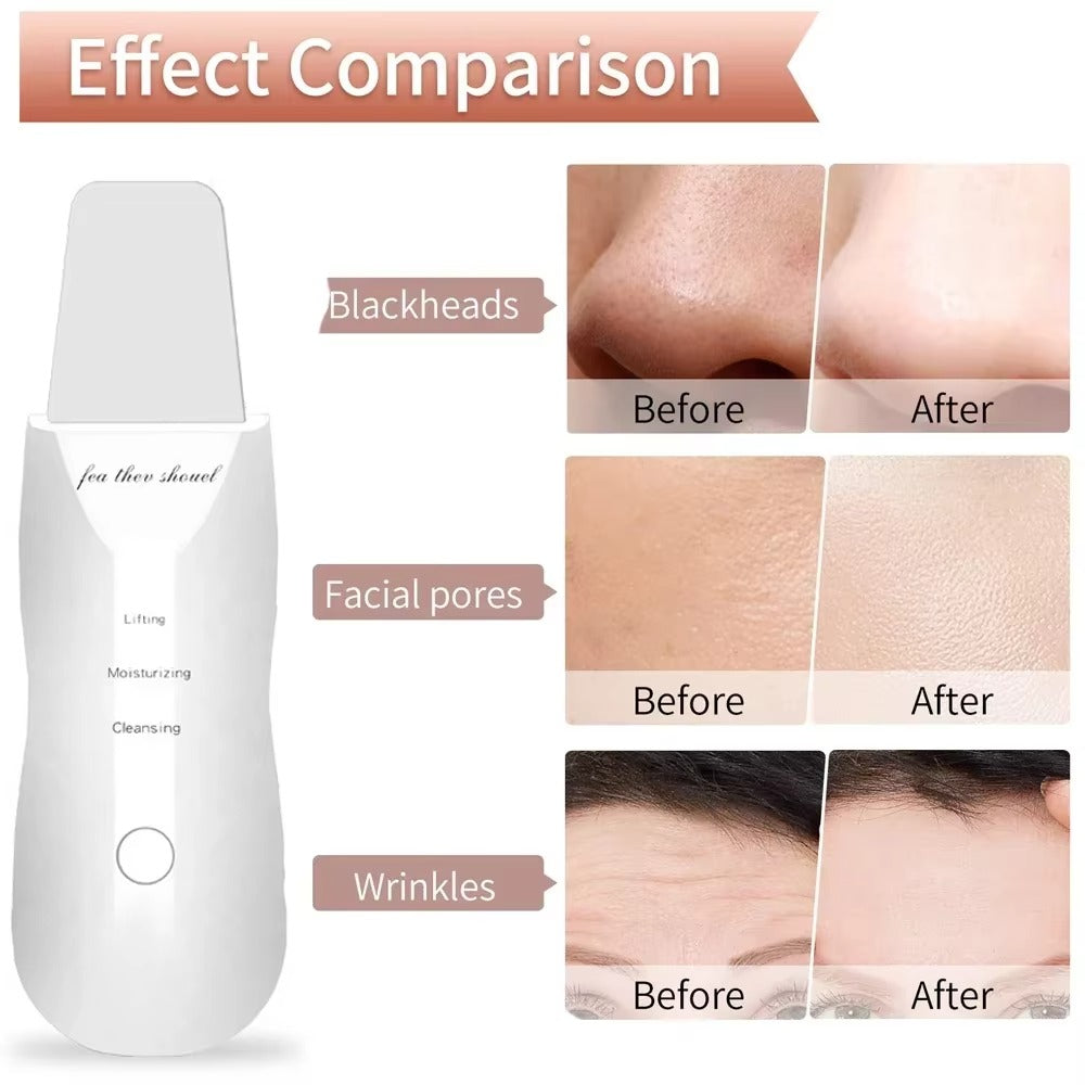 Electric Skin Scrubber
