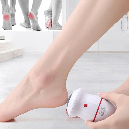 Electric Foot Callus Remover  Electronic Dead Skin Grinder